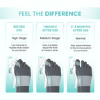 ERGO Bunion Corrector
