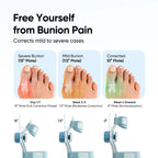 Frido Orthotics Bunion Corrector