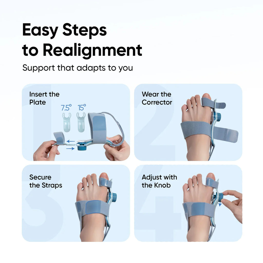 Frido Orthotics Bunion Corrector