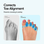 Frido Orthotics Toe Separator